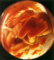 ovulo,donar ovulos dinero,ovulos dinero,placenta,placenta donar,utero,utero materno,utero madre,feto,feto bebe,feto materno,feto madre